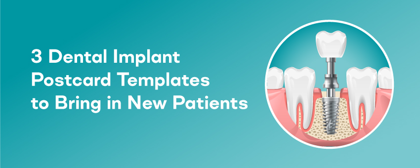3 Dental Implant Postcard Templates to Bring in New Patients